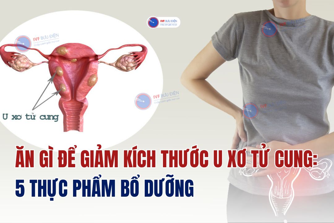 Ăn gì để giảm kích thước u xơ tử cung: 5 thực phẩm bổ dưỡng