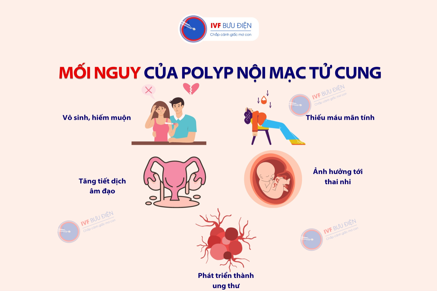 Những biến chứng nguy hiểm của polyp nội mạc tử cung