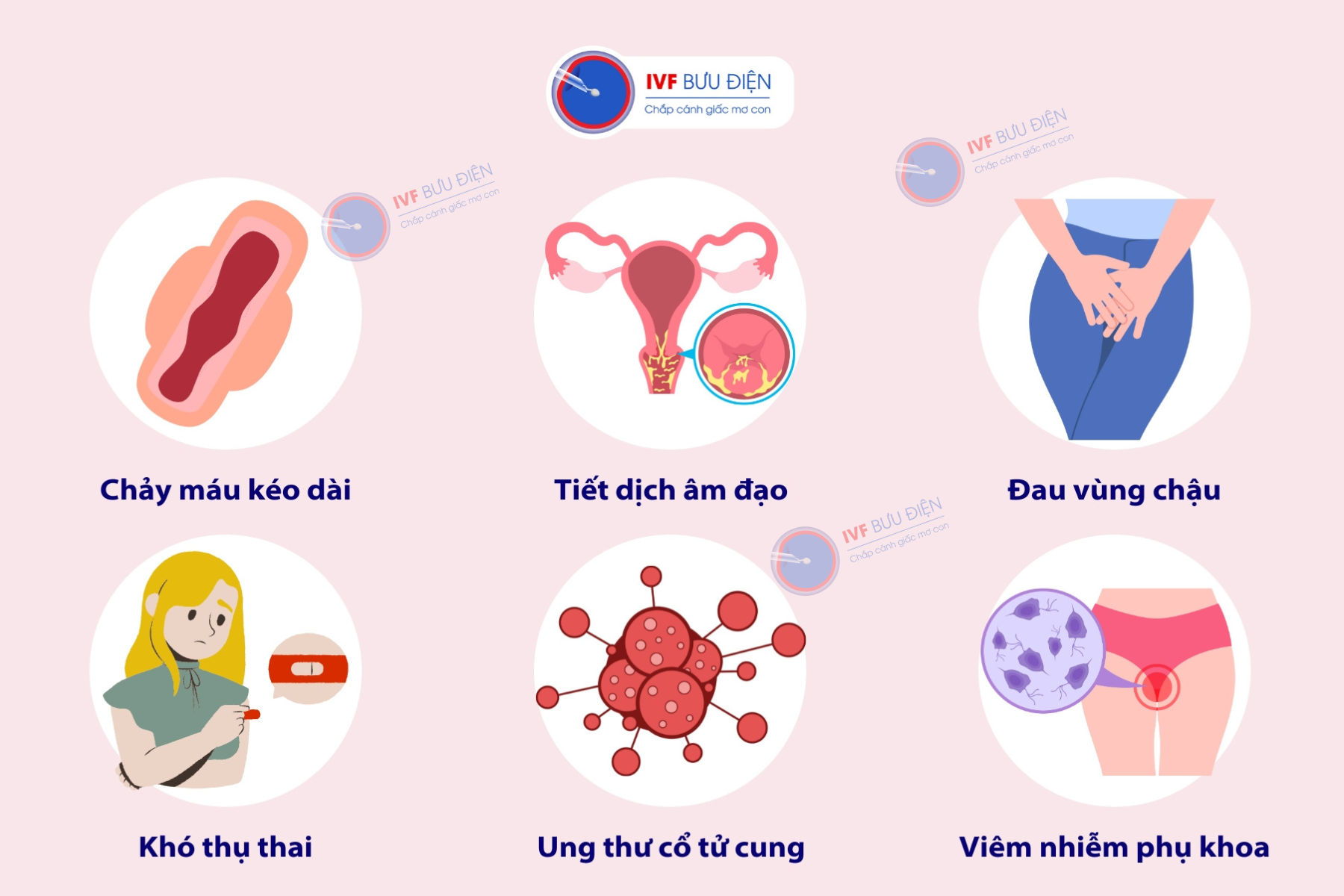 Biến chứng nguy hiểm của bệnh Polyp cổ tử cung