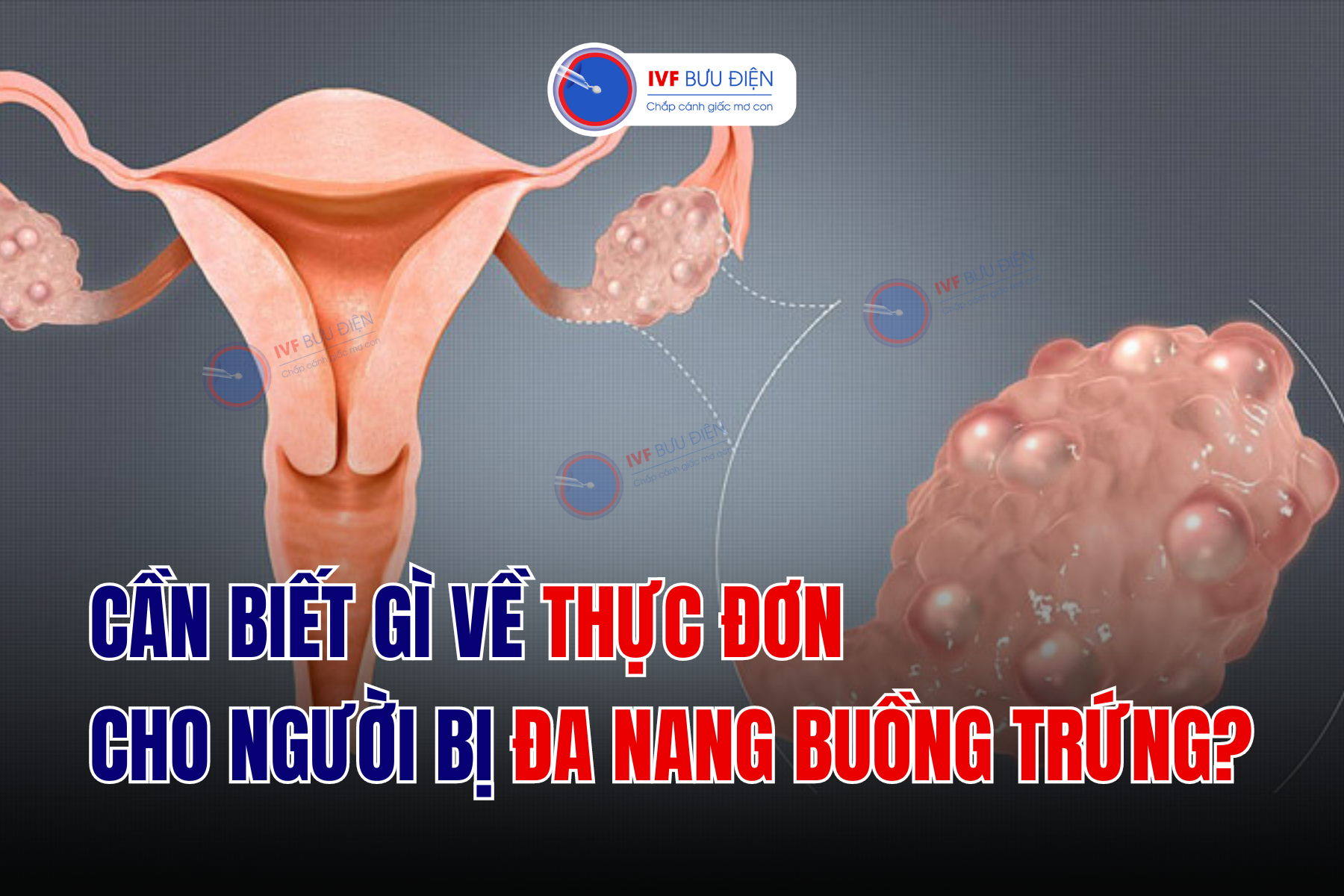 Thực đơn cho người bị đa nang buồng trứng như thế nào?