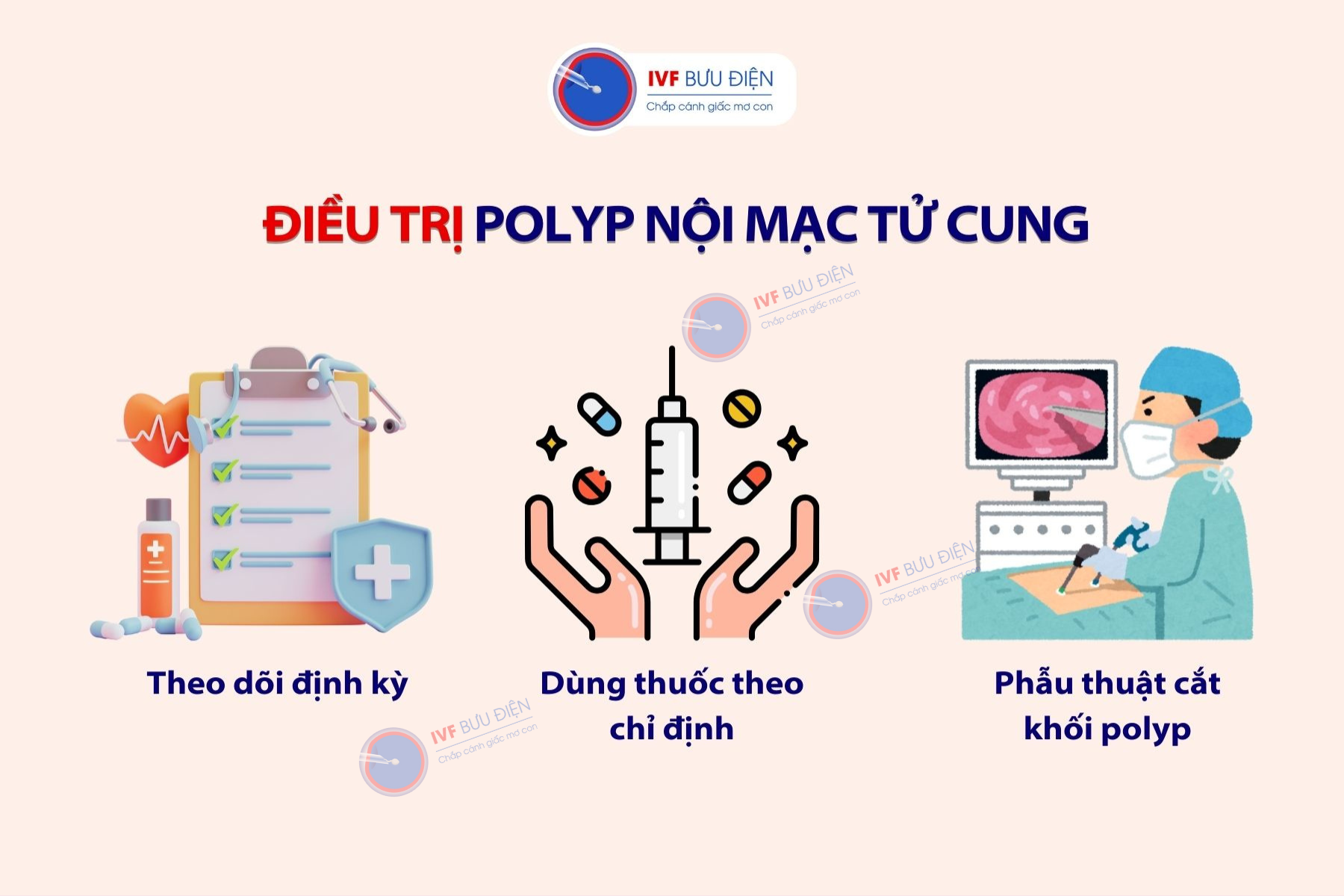 Phương pháp điều trị polyp nội mạc tử cung