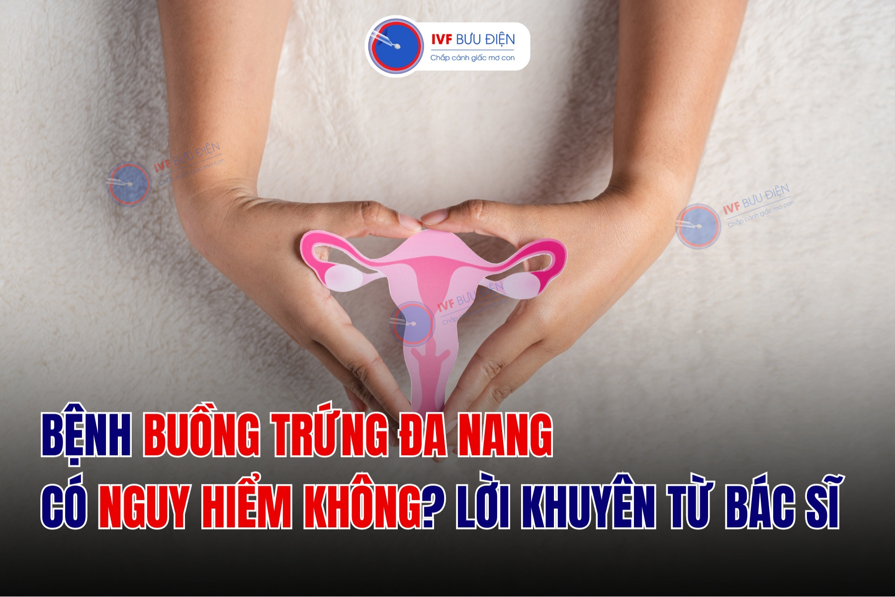 Buồng trứng đa nang có nguy hiểm không? Nắm rõ 4 biến chứng