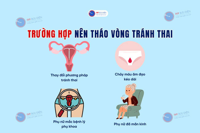 Một số trường hợp nên tháo vòng tránh thai