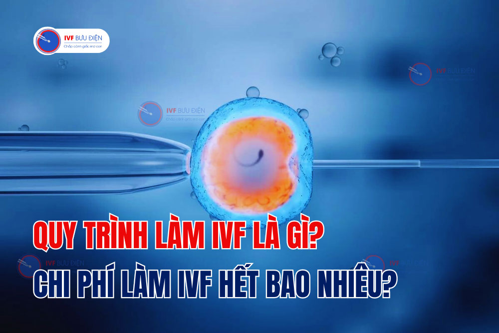 Quy trình làm IVF là gì? Chi phí làm IVF hết bao nhiêu?