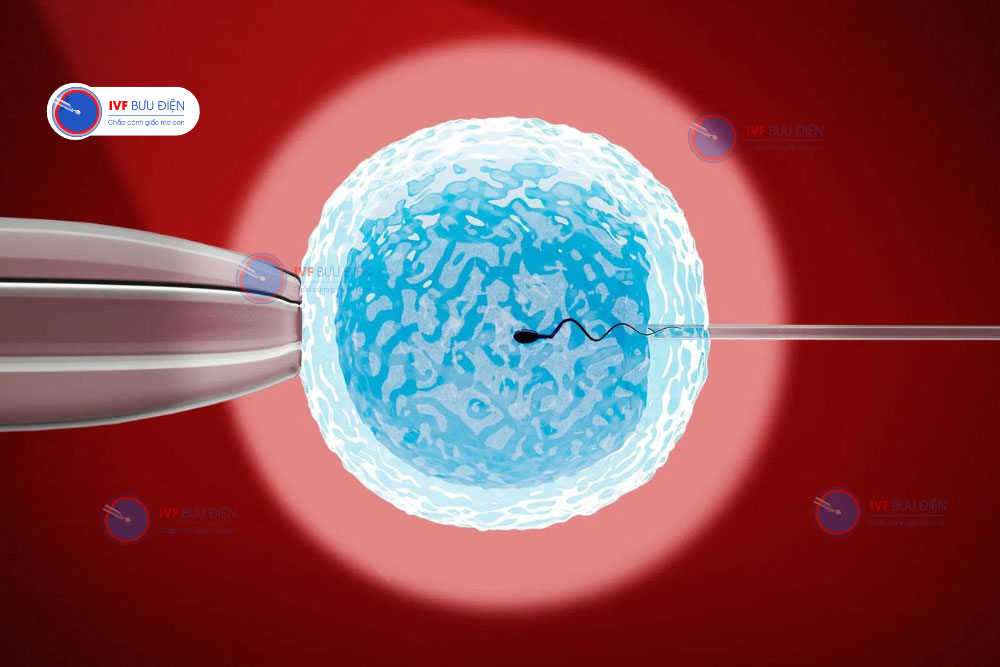  ivf - thụ tinh ống nghiệm