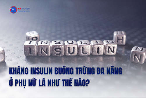 Tình trạng kháng insulin ở phụ nữ mắc buồng trứng đa nang