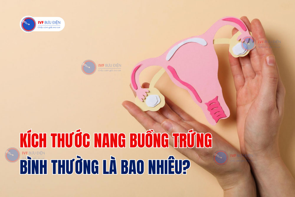 Bác sĩ giải đáp: Kích thước nang buồng trứng bình thường