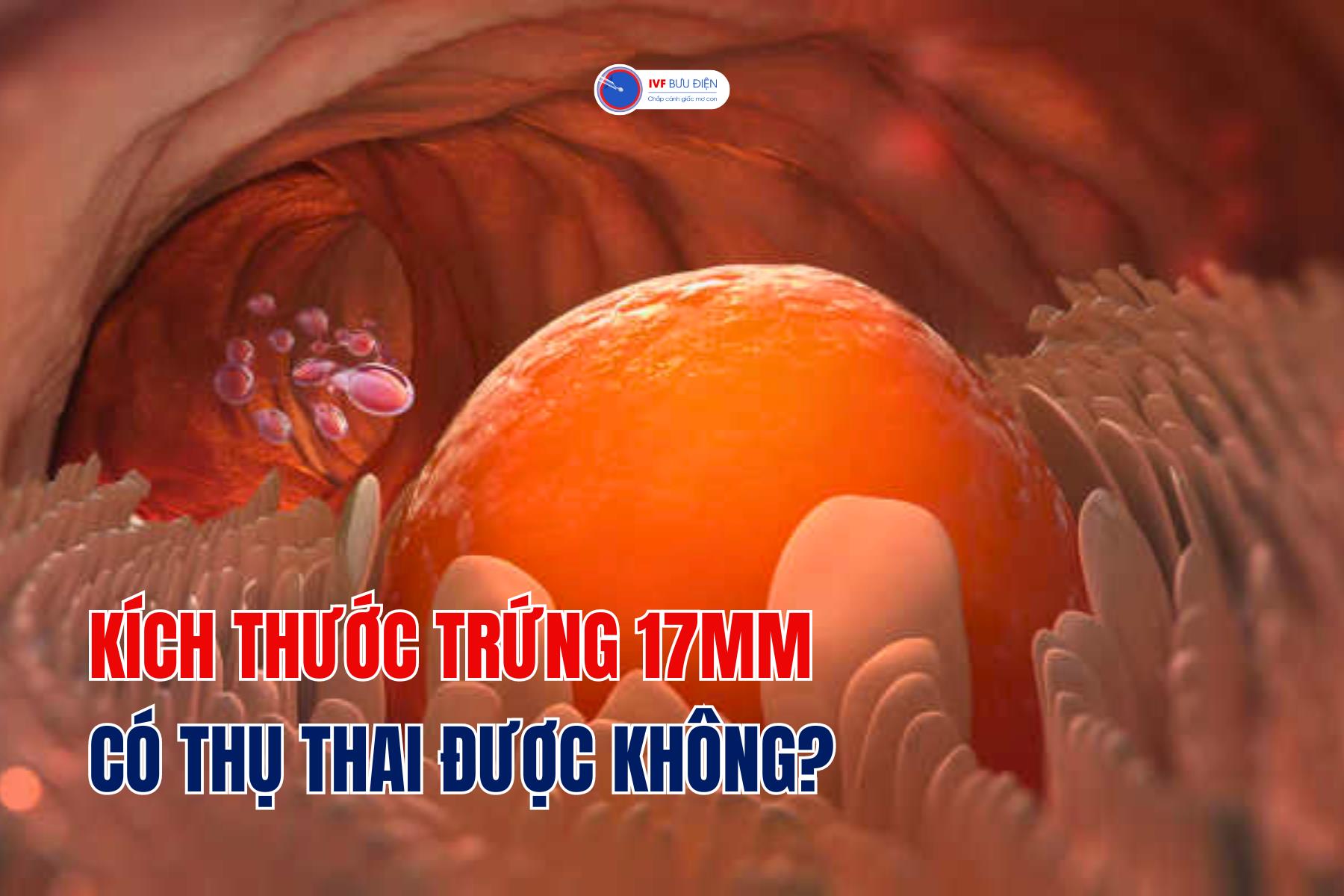 Kích thước trứng 17mm có thụ thai được không? | IVF Bưu điện