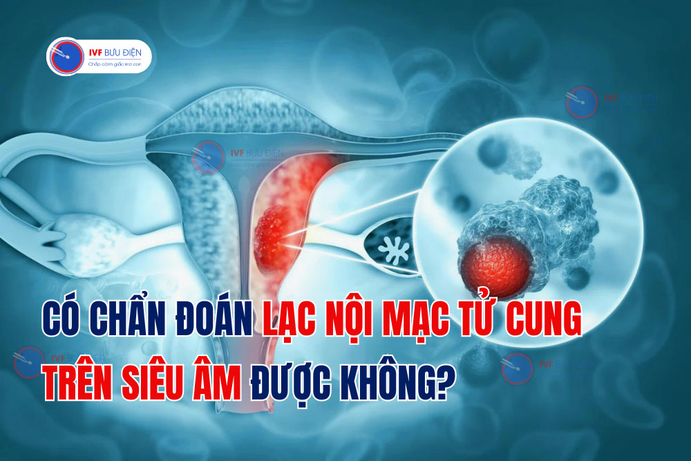 Có chẩn đoán lạc nội mạc tử cung trên siêu âm được không?