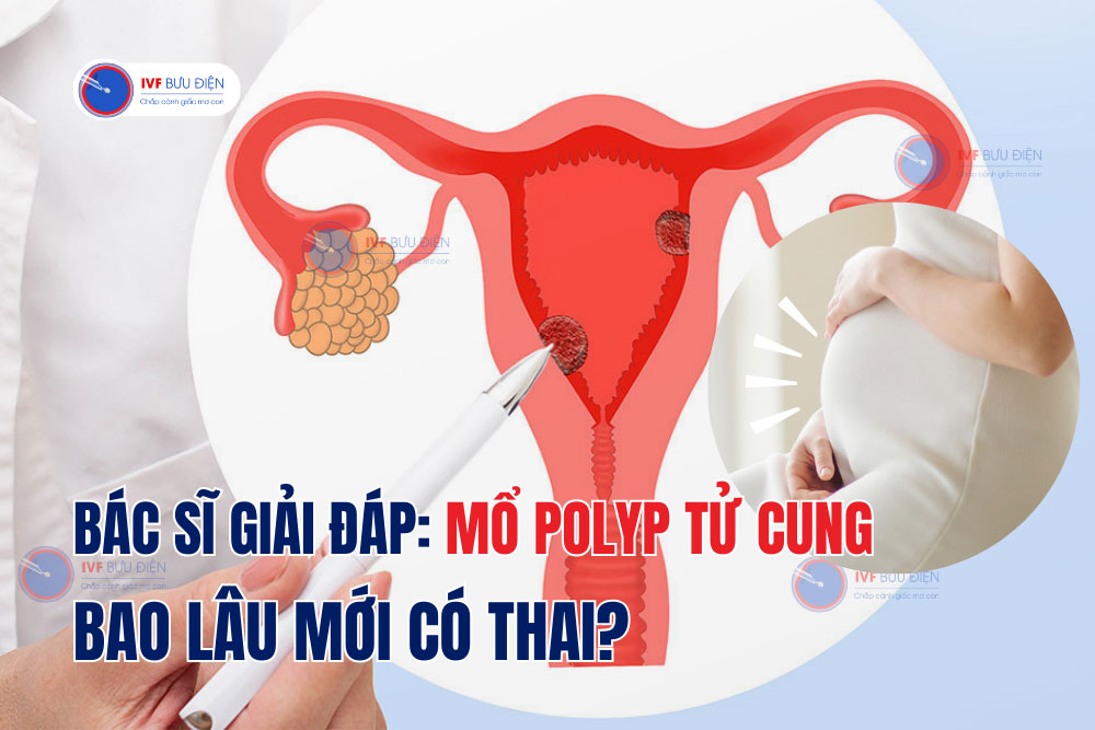 Bác sĩ giải đáp: Mổ polyp tử cung bao lâu mới có thai?