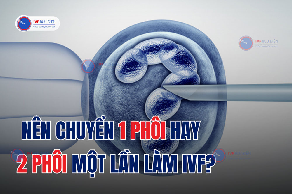 Nên chuyển 1 phôi hay 2 phôi một lần làm IVF?