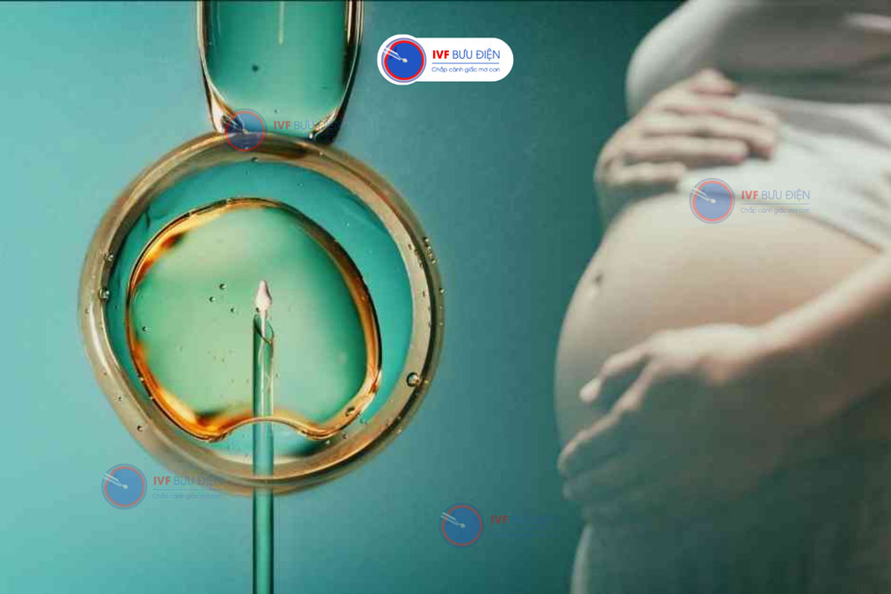 Nên chuyển 1 phôi hay 2 phôi tại IVF Bưu Điện