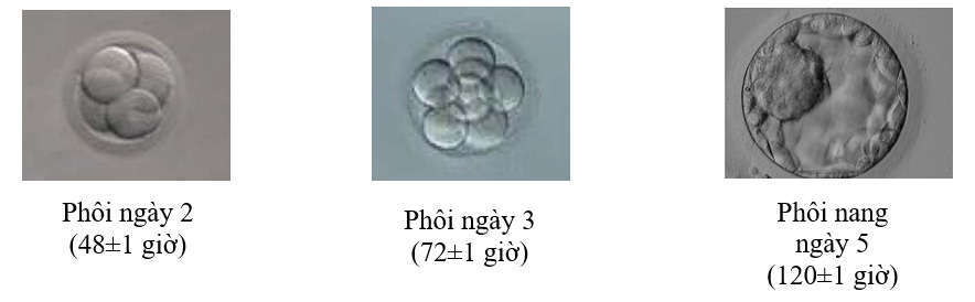 Kỹ thuật nuôi phôi ngày 5 kép kín