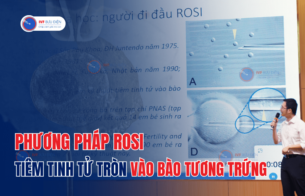 Phương pháp ROSI – Tiêm tinh tử tròn vào bào tương trứng