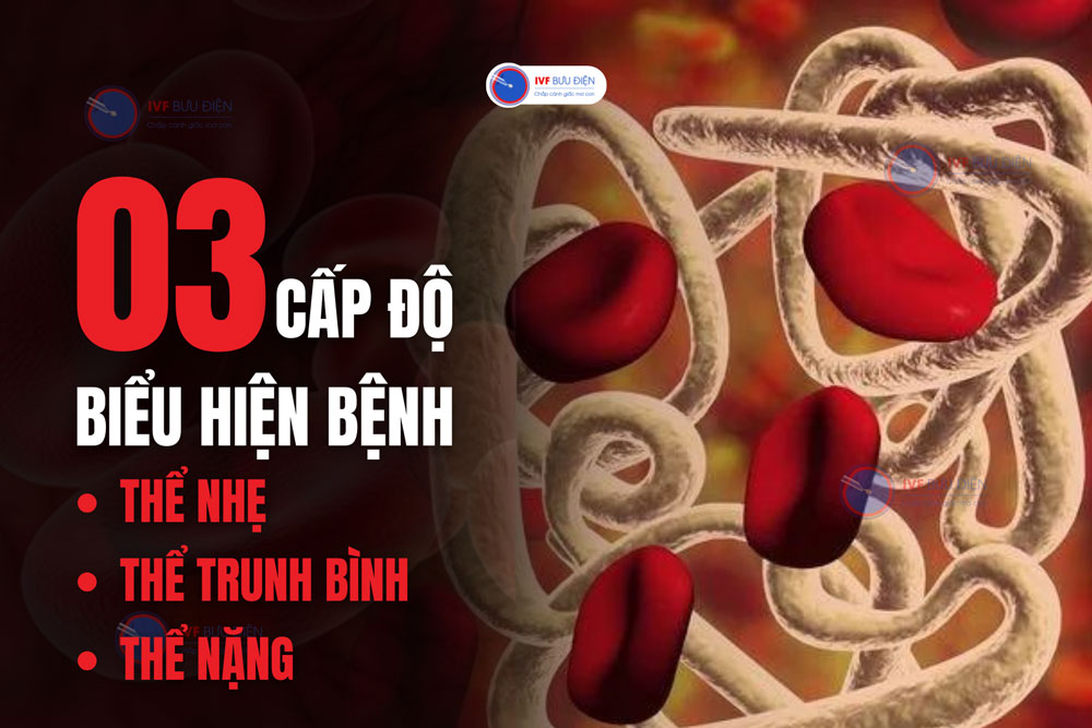 Dấu hiệu bệnh Thalassemia phụ thuộc vào 3 cấp độ bệnh