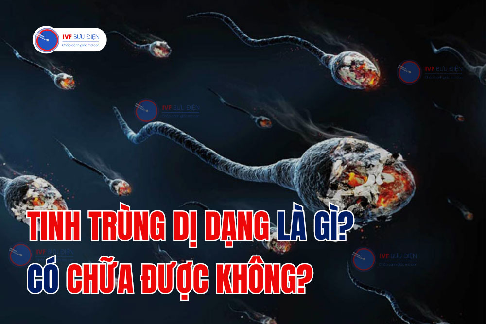 Tinh trùng dị dạng là gì? Có chữa được không?