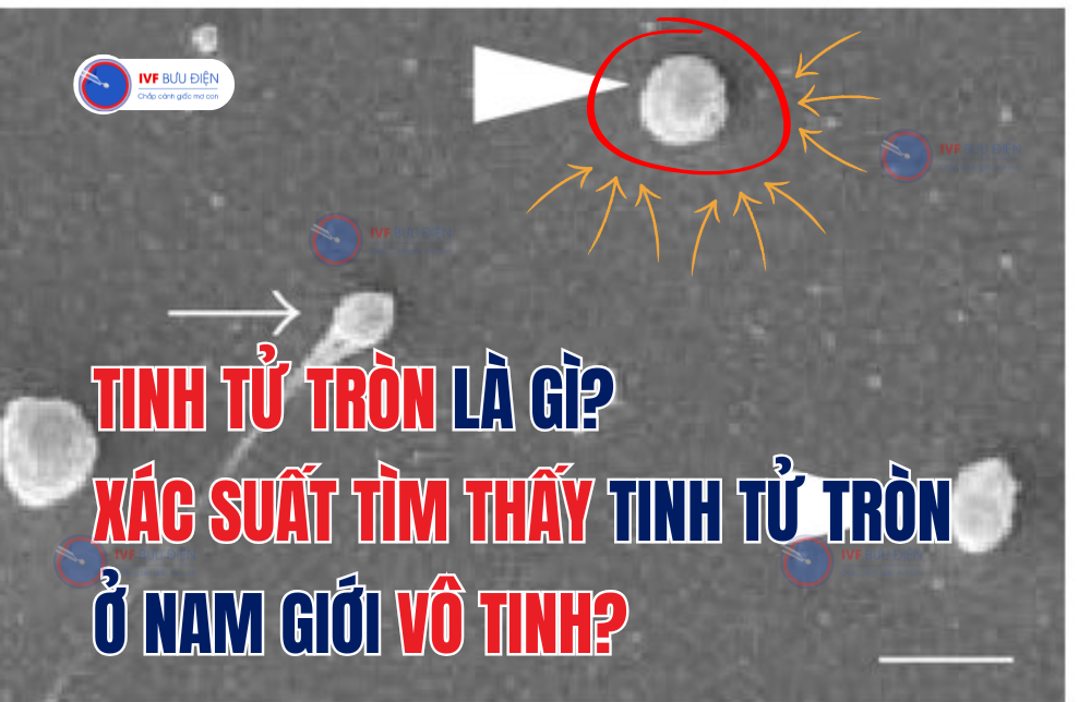 Tinh tử tròn là gì?  Xác suất thấy tinh tử tròn ở nam giới vô tinh