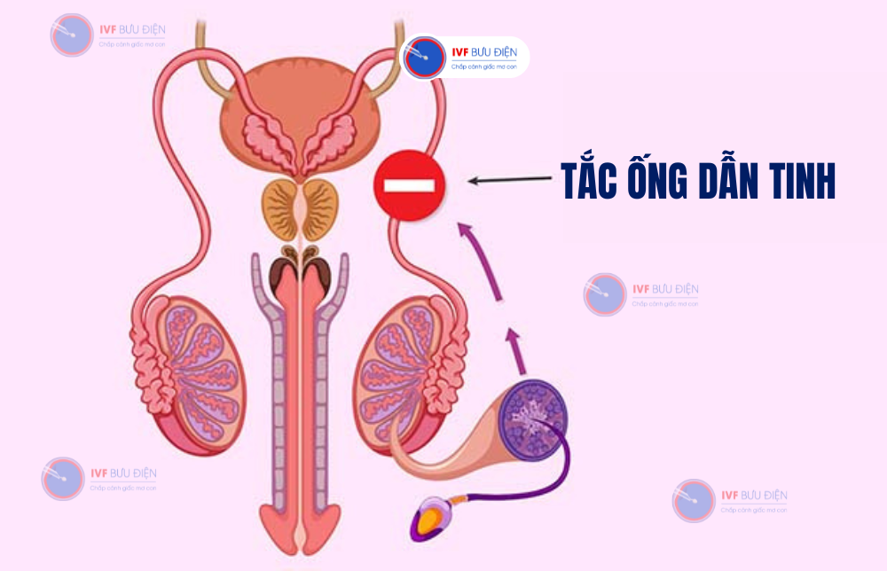  ai có tinh tử tròn