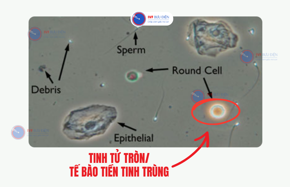 tinh tử tròn hình ảnh