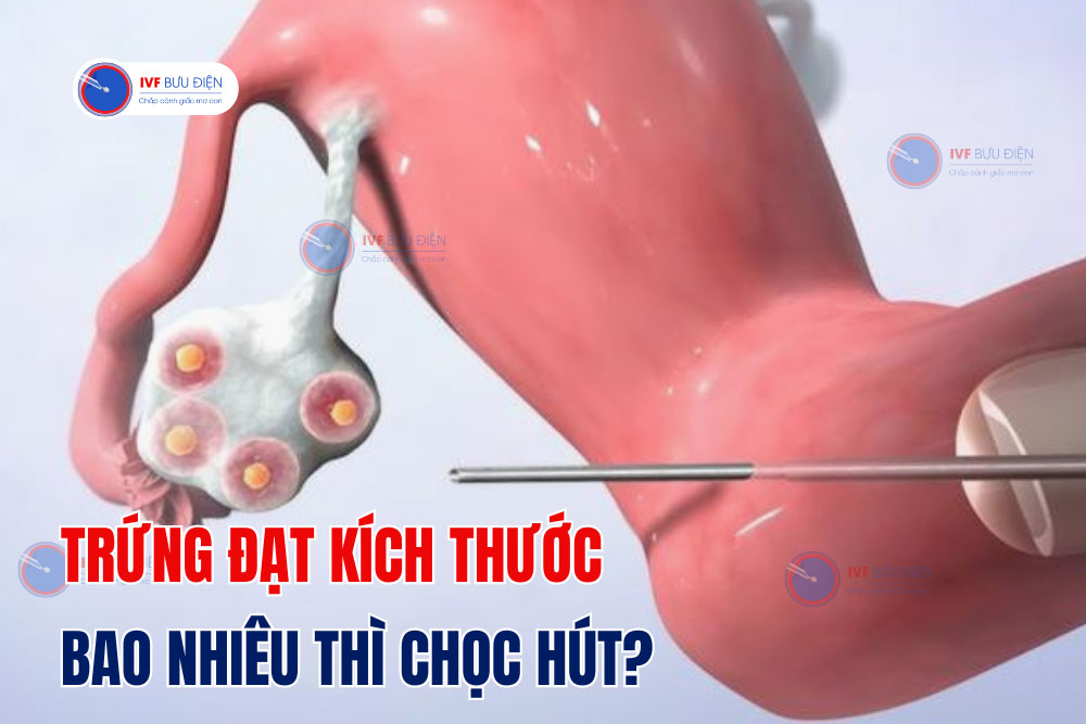 Trứng đạt kích thước bao nhiêu thì chọc hút là lý tưởng nhất?