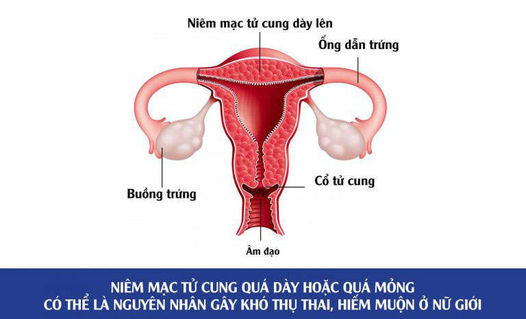 4. Ứng Dụng PRP Trong Hỗ Trợ Sinh Sản