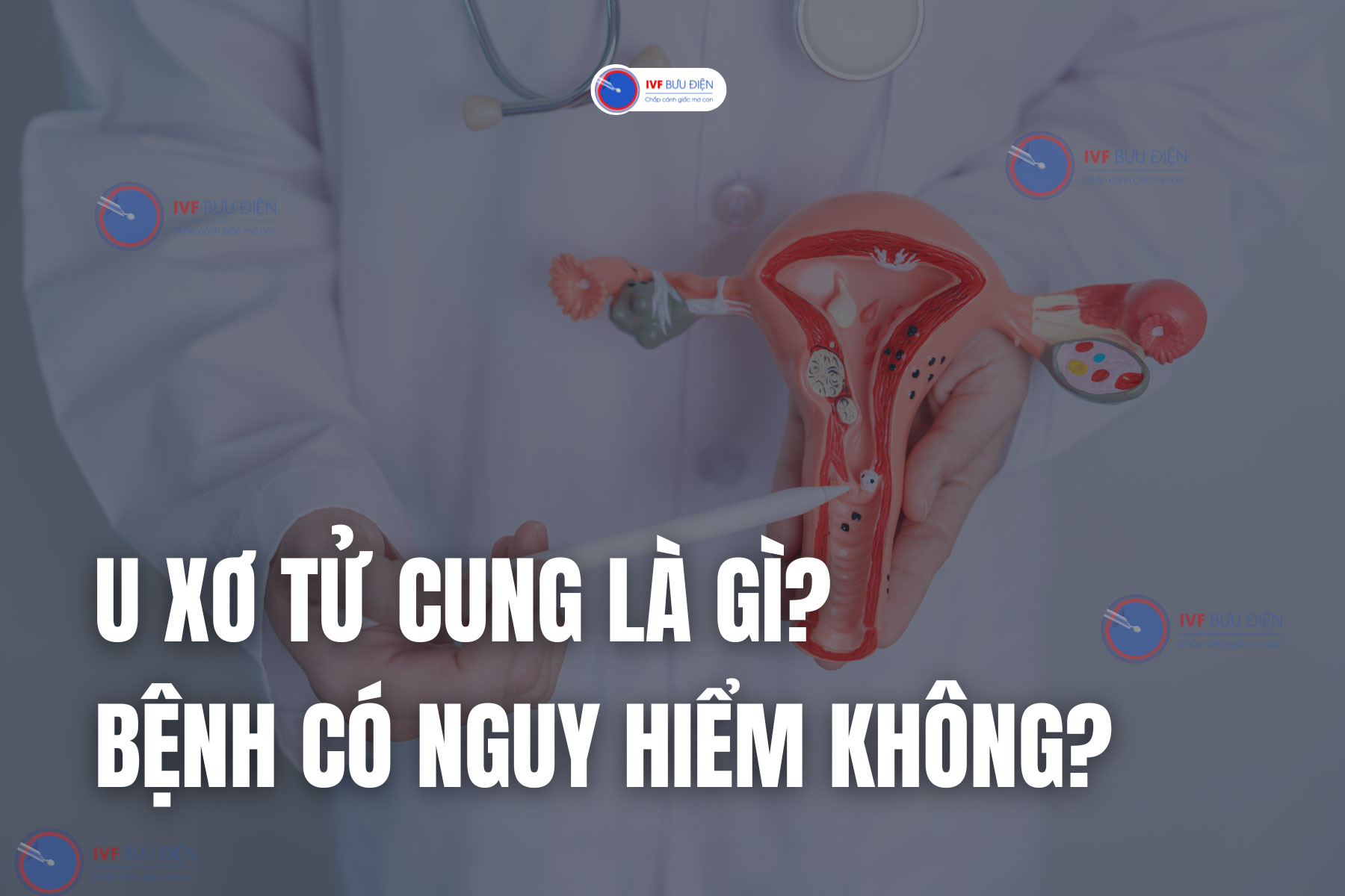 U xơ tử cung là gì? Có nguy hiểm không?