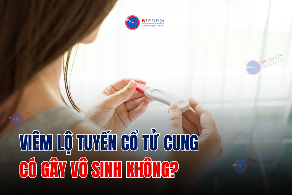 Viêm lộ tuyến cổ tử cung có gây vô sinh không?