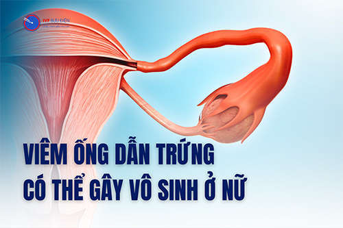 Viêm ống dẫn trứng có thể gây vô sinh ở nữ